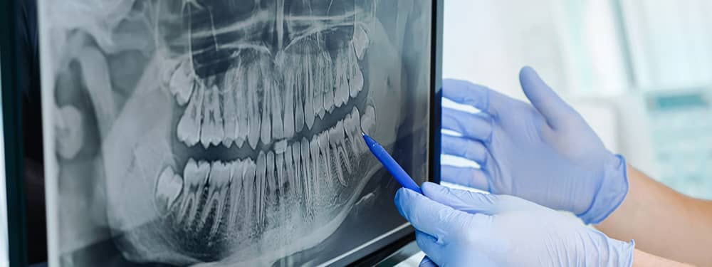 The types of loans for dental practices